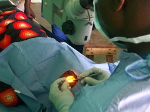 Dr. Avar removing a cataract in Pero.  He could do a cataract surgery in 15-20 minutes